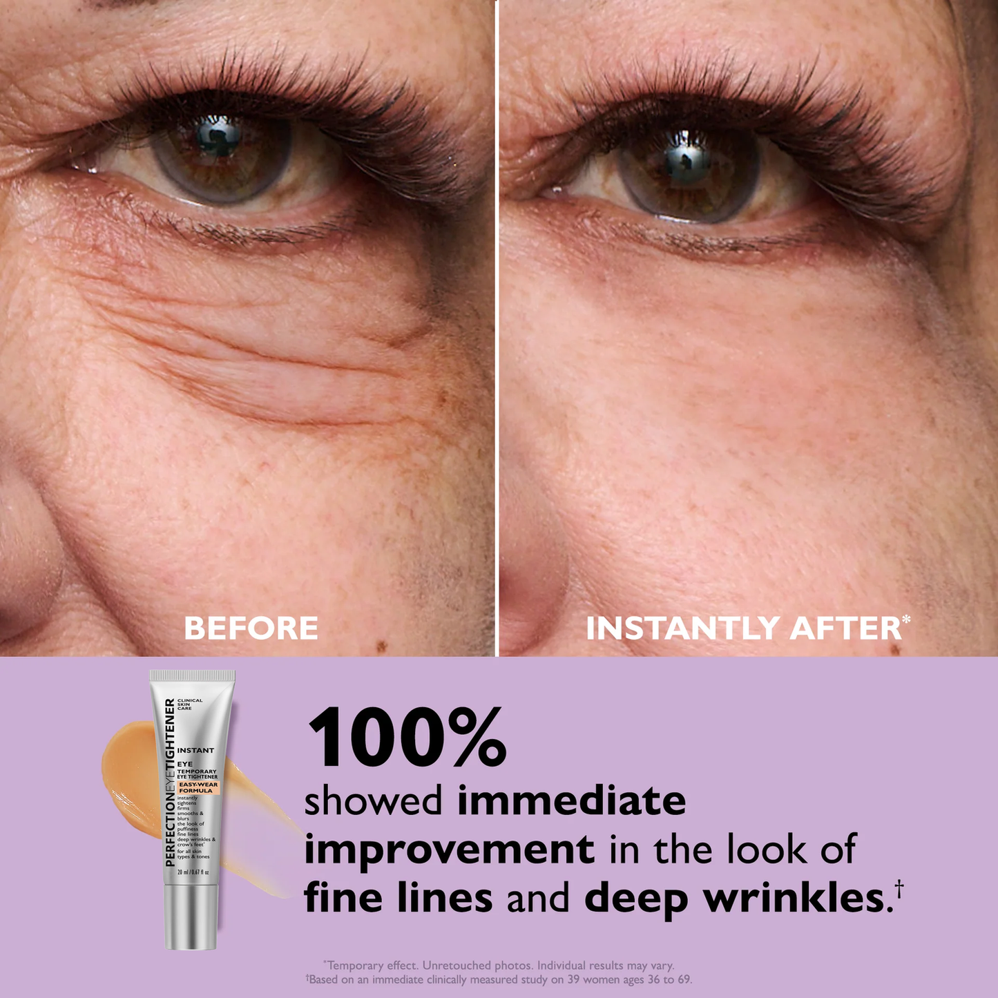 Luméa Lift™ Eye Tightener