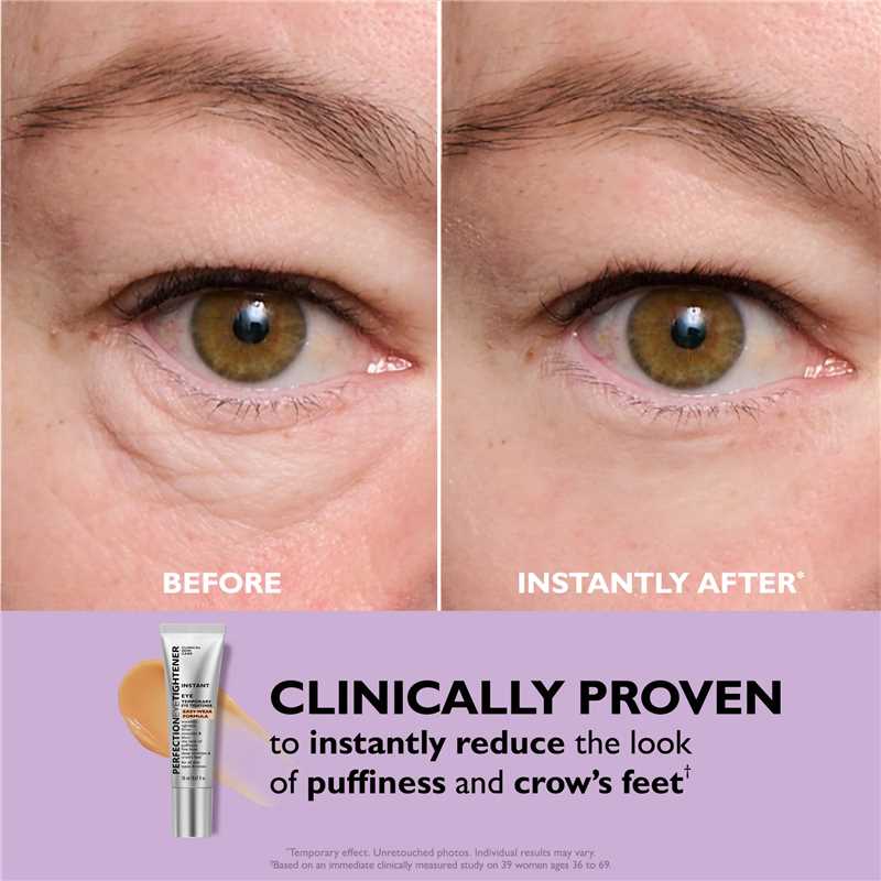 Luméa Lift™ Eye Tightener